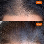 1 Lit Jadamudi Natural Hair Oil