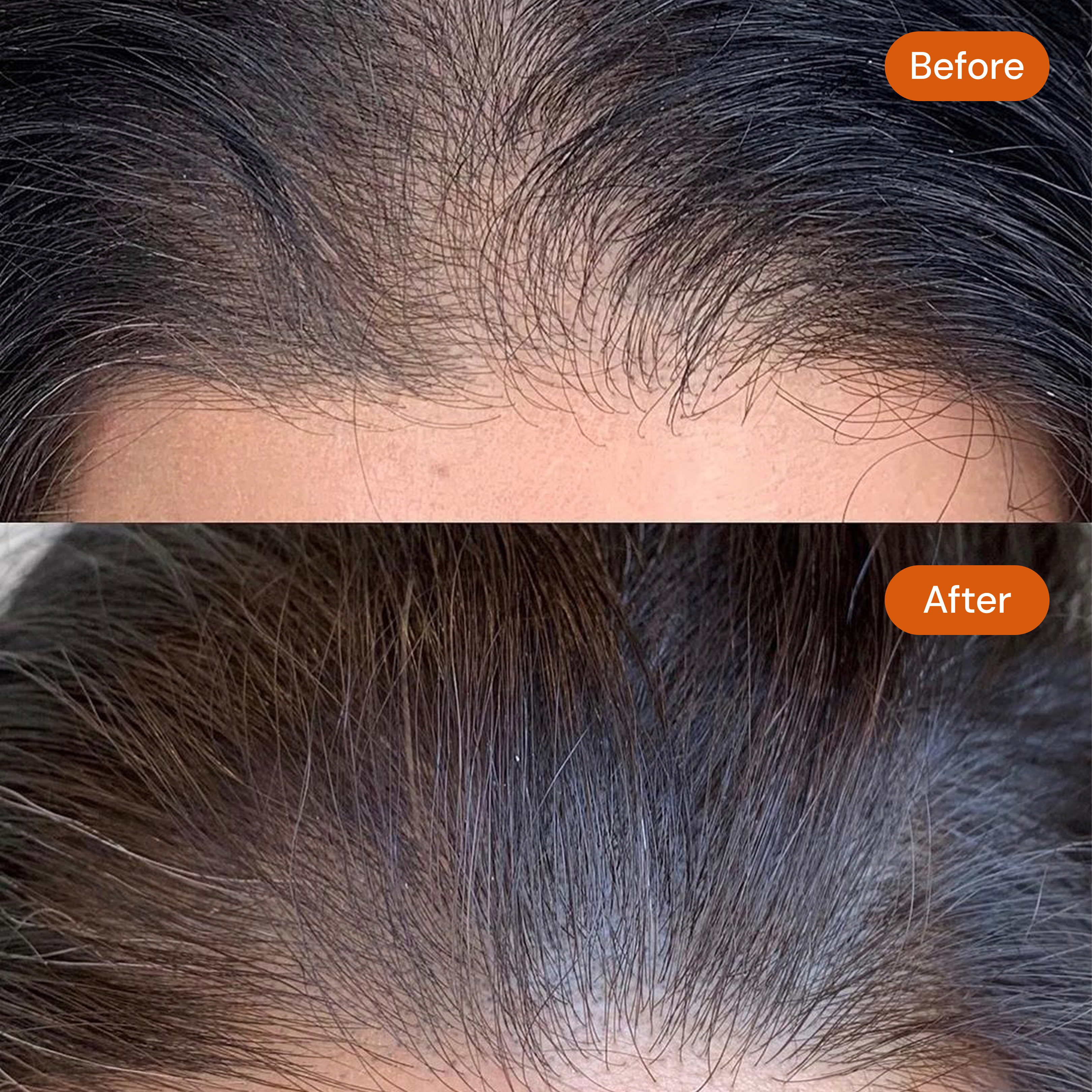 1 Lit Jadamudi Natural Hair Oil